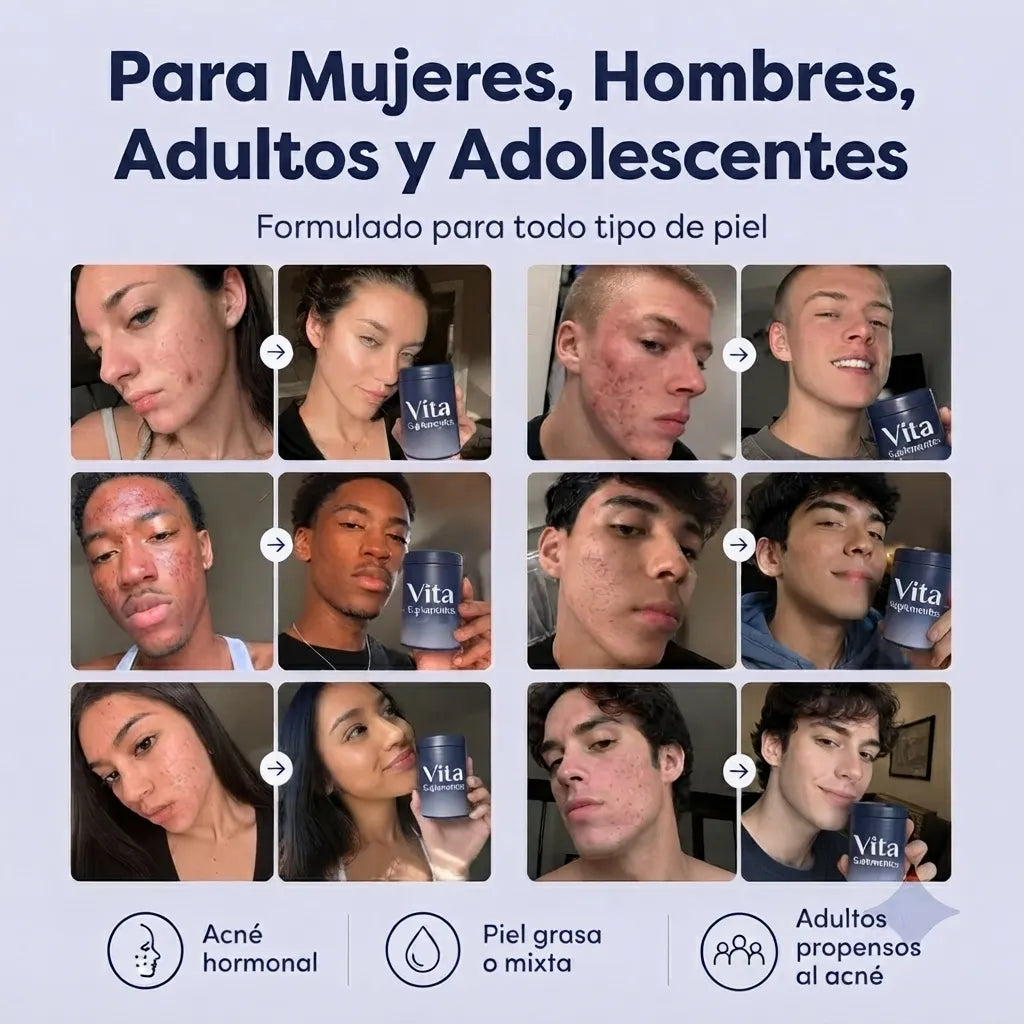 SkinClear Capsulas — Vita Suplementos
