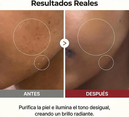 Ampolla De Cáscara De Arroz — VITA COSMETICS®