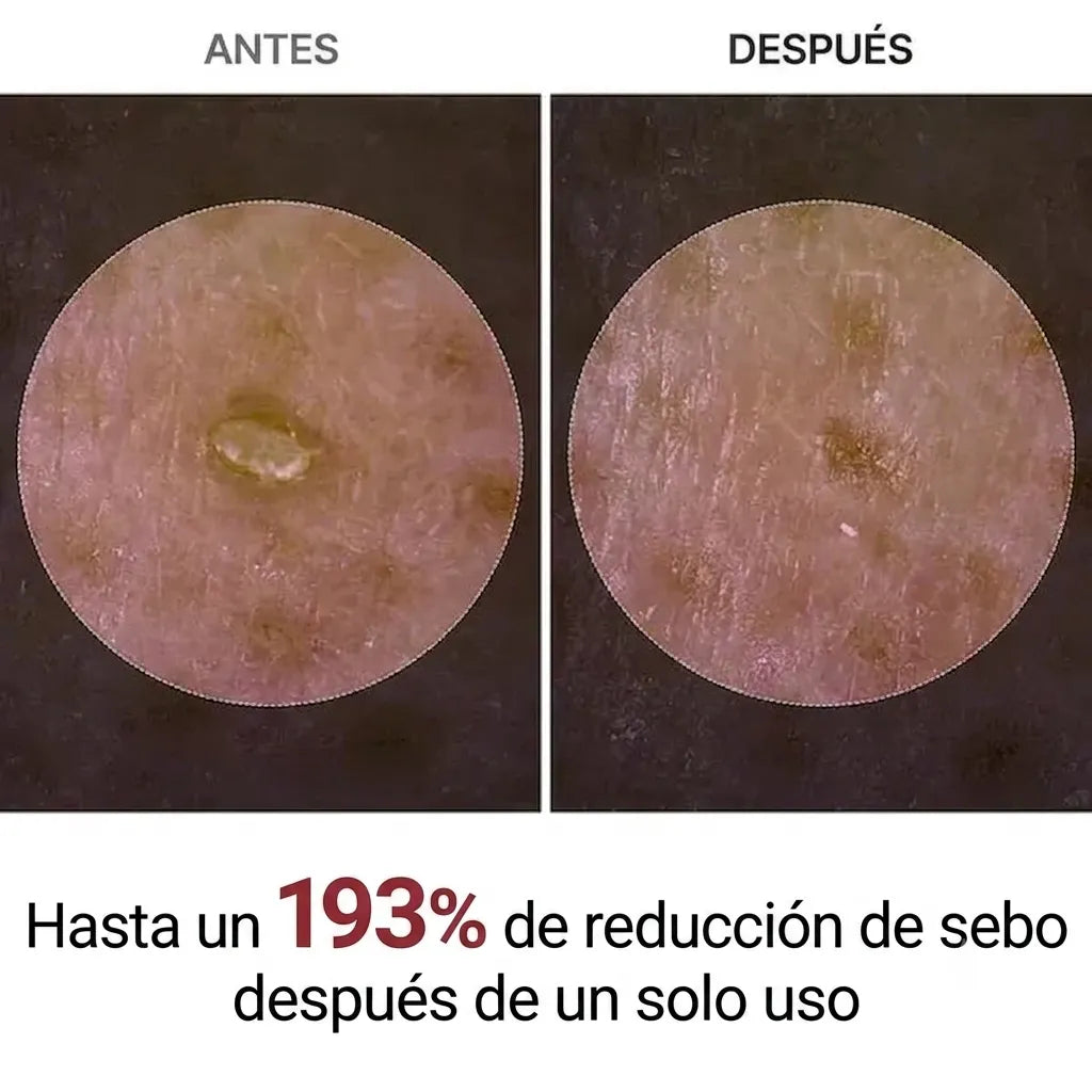 Ampolla De Cáscara De Arroz — VITA COSMETICS®