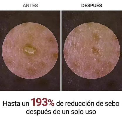 Ampolla De Cáscara De Arroz — VITA COSMETICS®